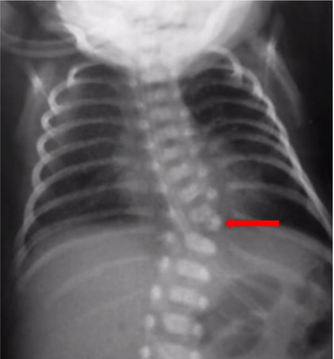 FIGURE 4
