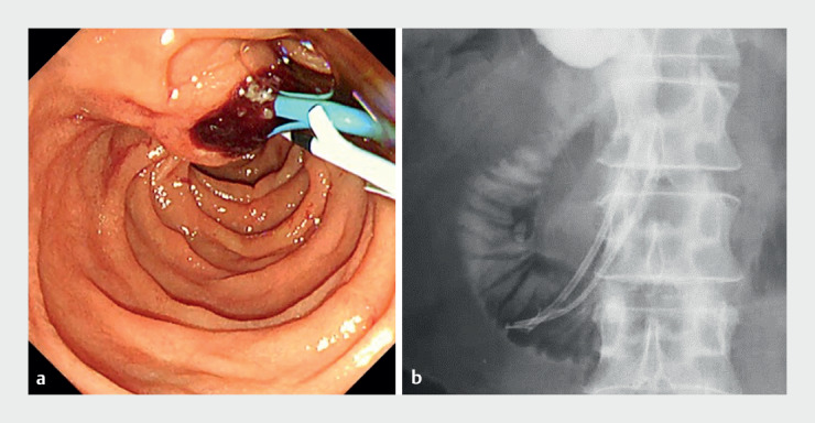 Fig. 1