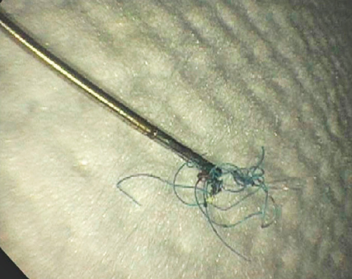 Fig. 4