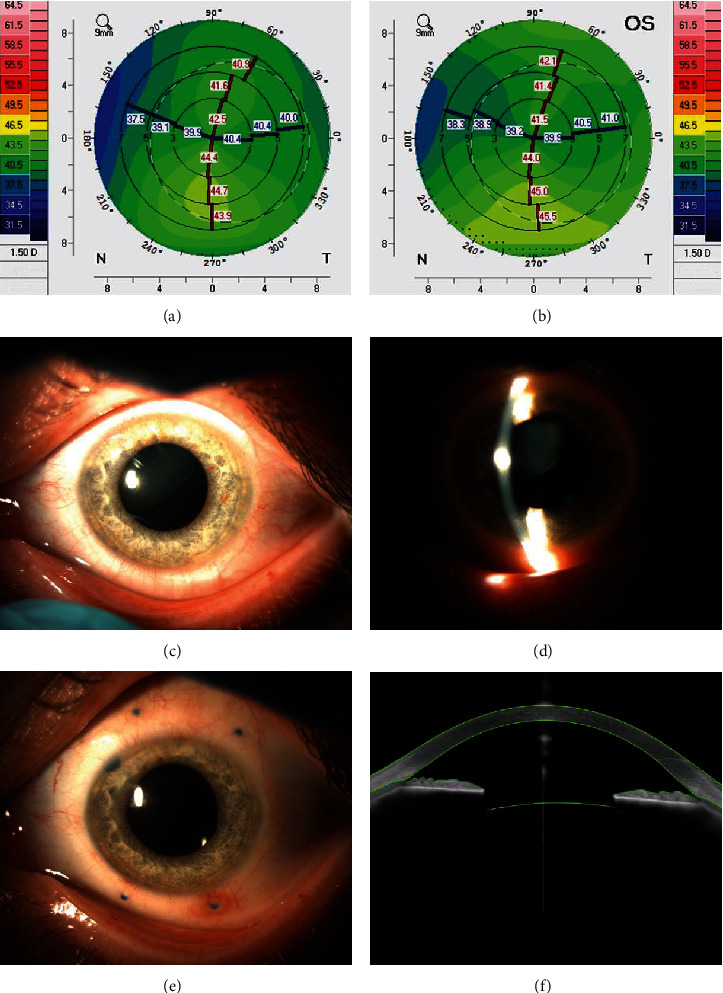 Figure 2