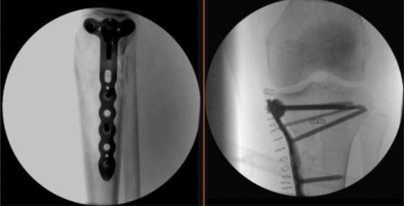 Figure 13