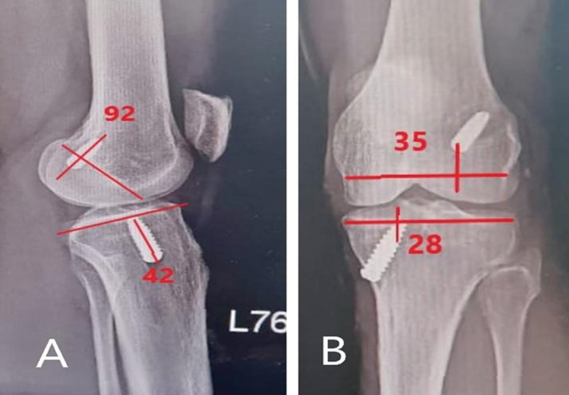 Figure 9