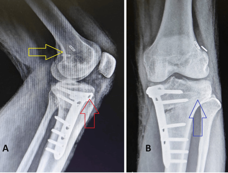 Figure 10