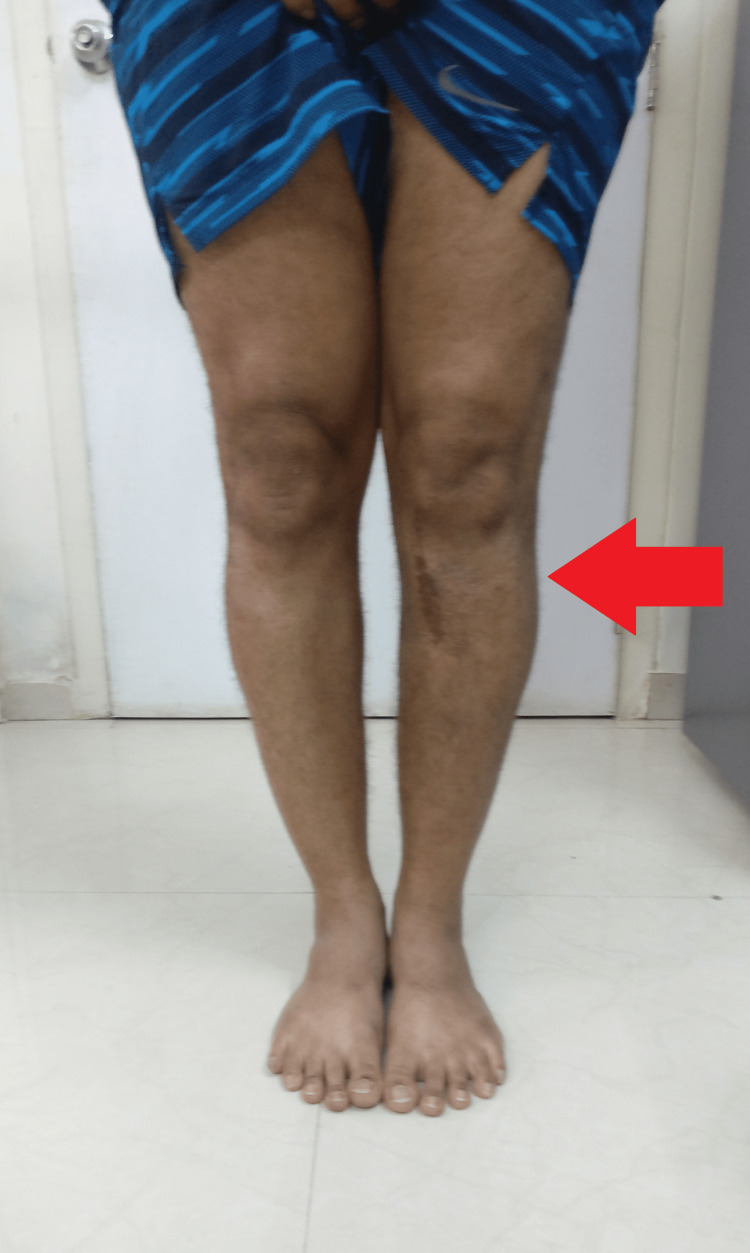 Figure 11