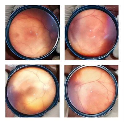 Fig. 2