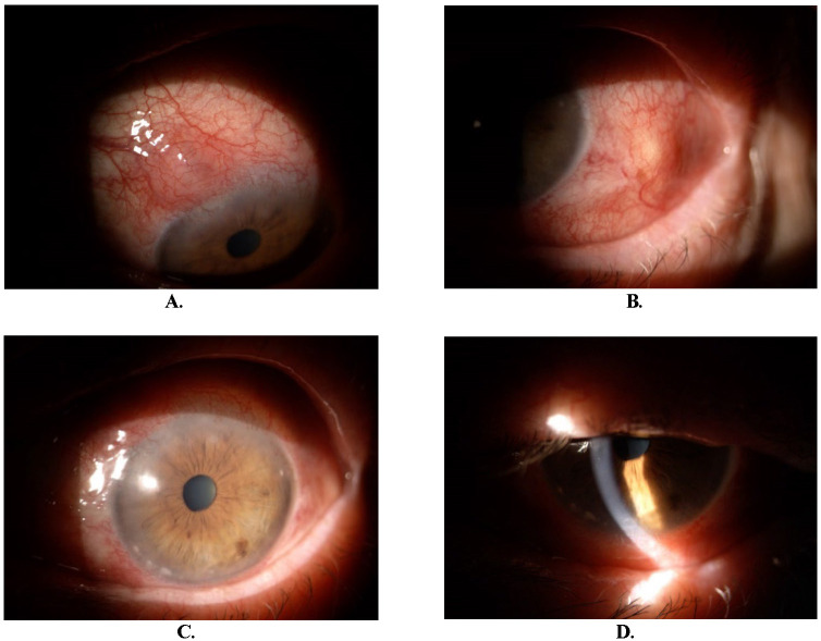 Fig. 4