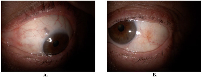 Fig. 6