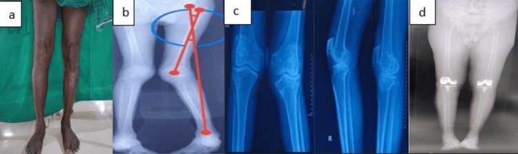 Figure 9