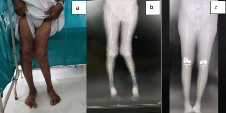 Figure 11
