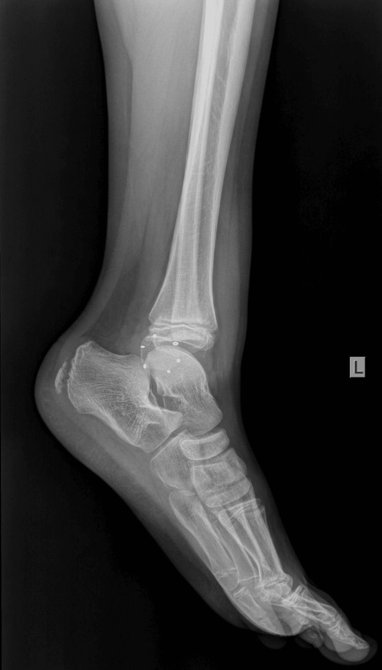 Figure 6