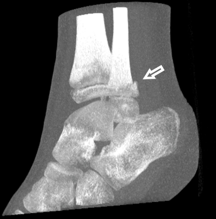 Figure 9