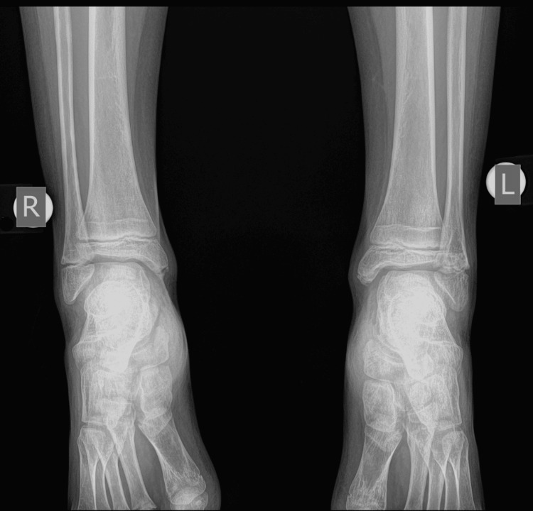 Figure 12