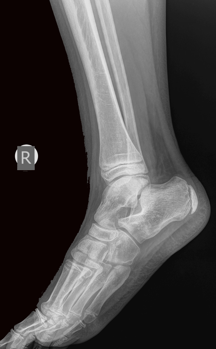 Figure 13