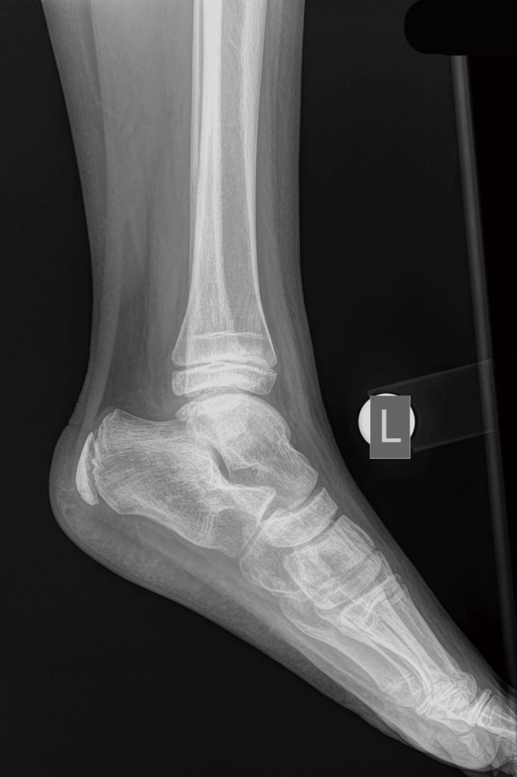 Figure 14