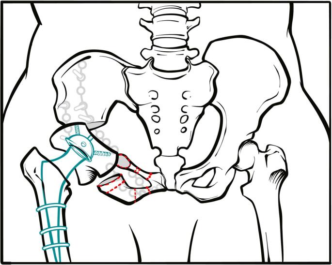 Figure 6