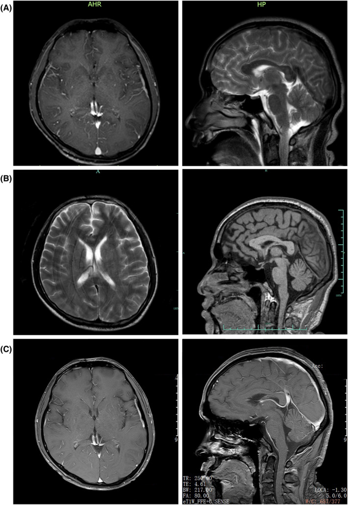 FIGURE 2