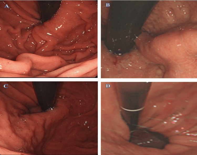 Figure 6