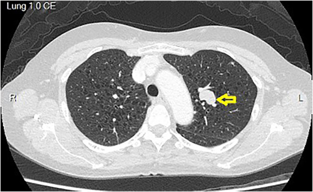 Figure 1