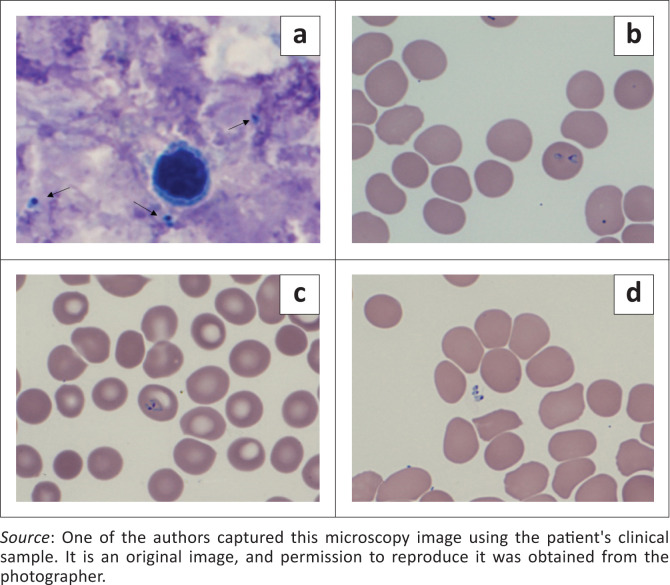 Figure 2