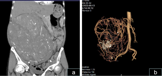 Figure 3