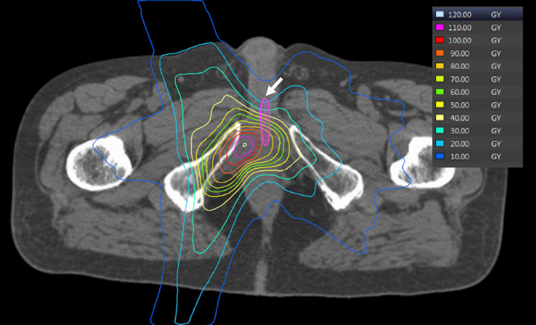 Figure 6
