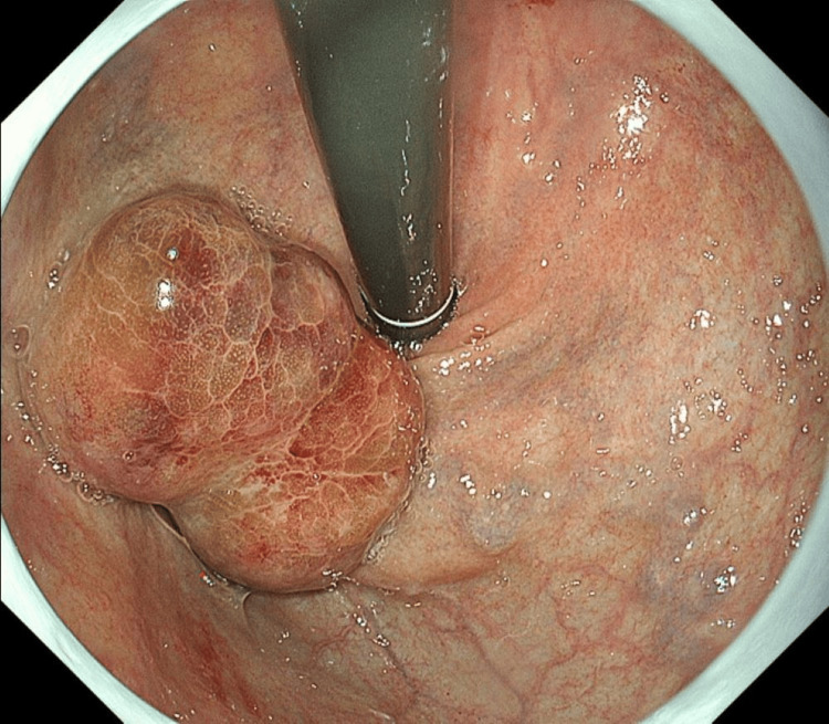 Figure 5
