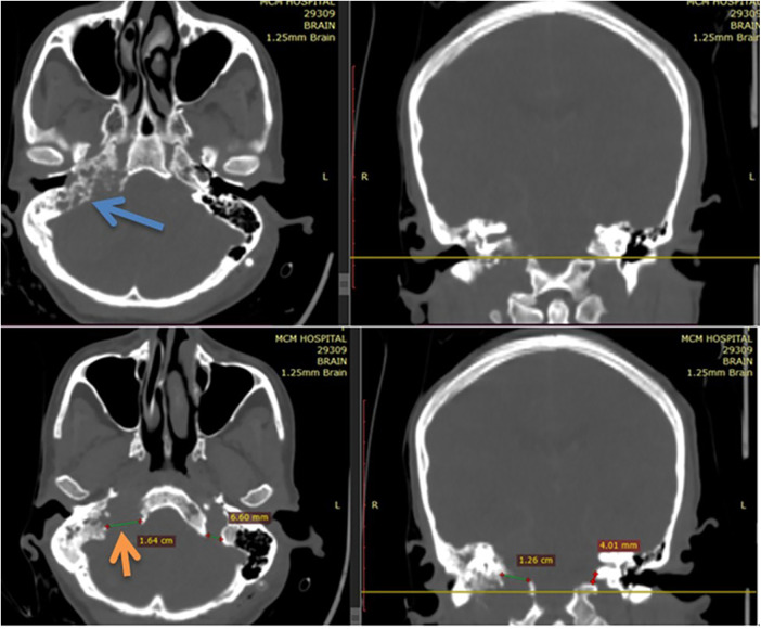 Figure 4