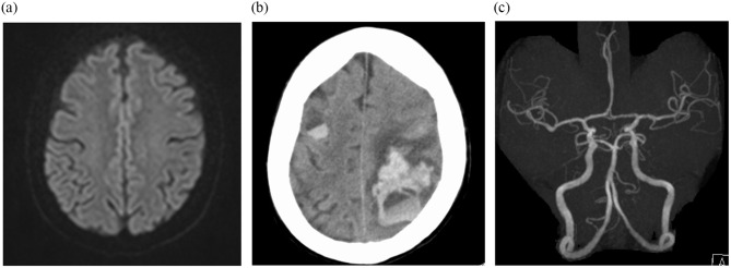 Figure 2