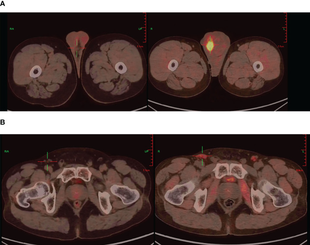 Figure 2