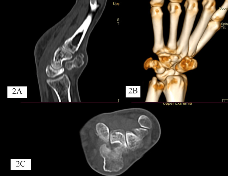 Figure 2