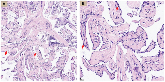 Figure 3