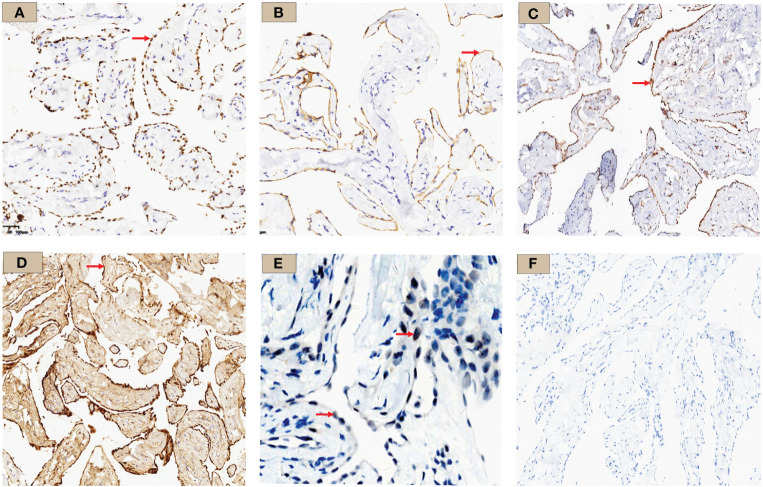 Figure 4
