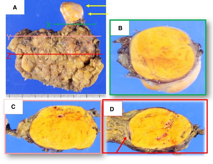 Figure 3