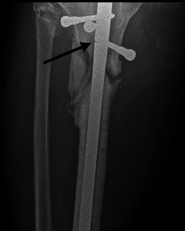 Figure 5