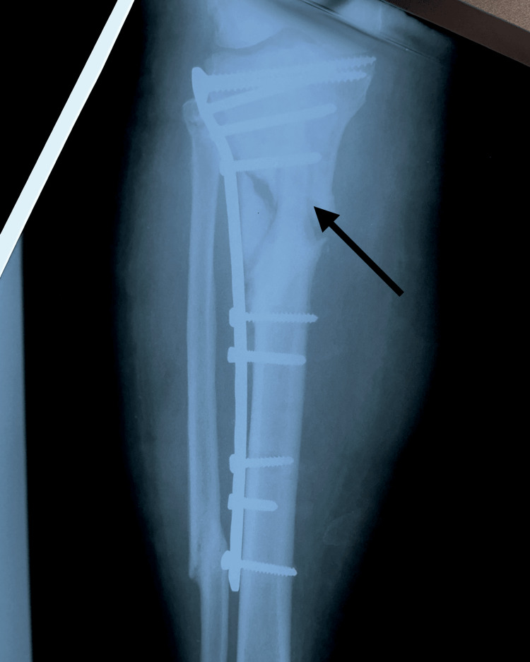 Figure 7