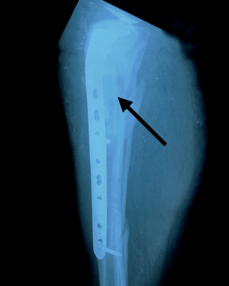 Figure 8