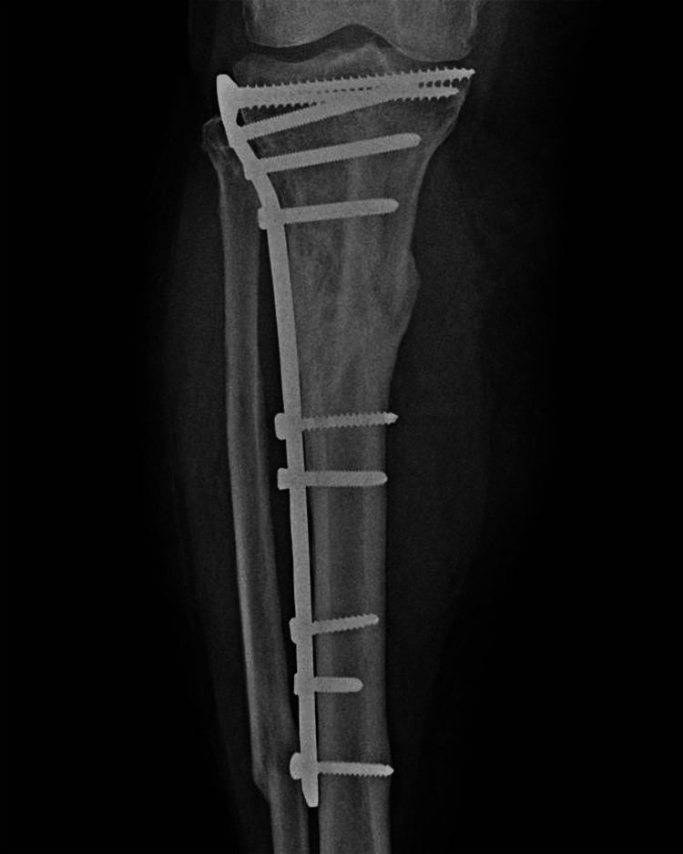 Figure 15