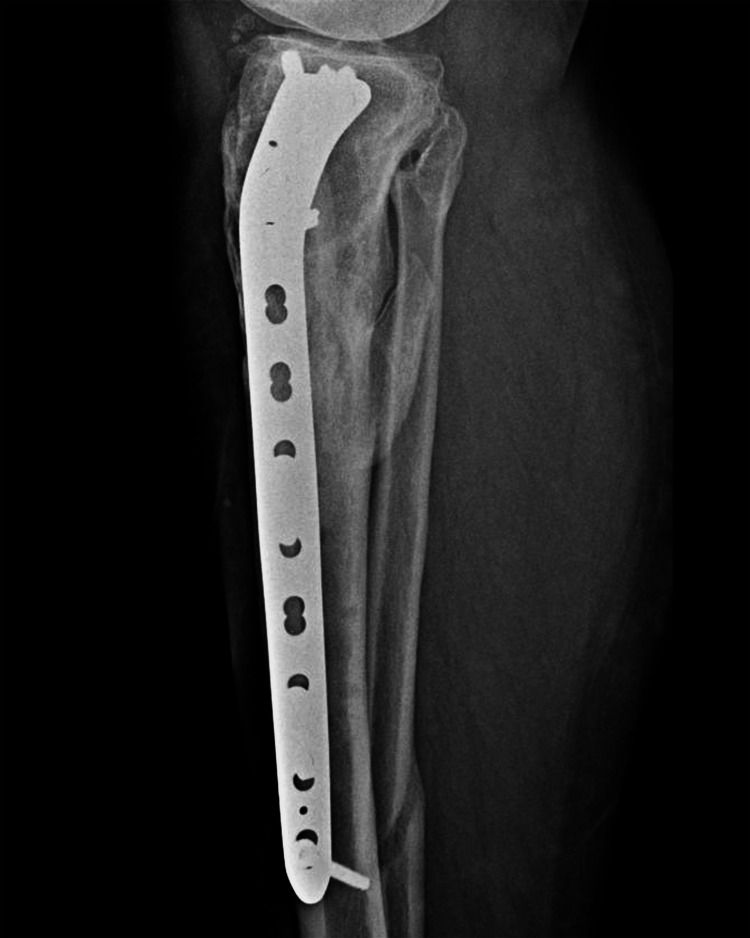 Figure 16