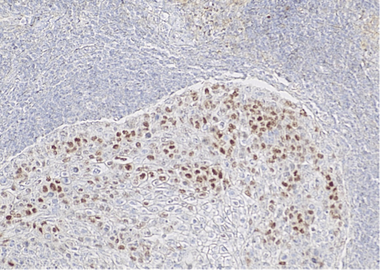 Figure 9
