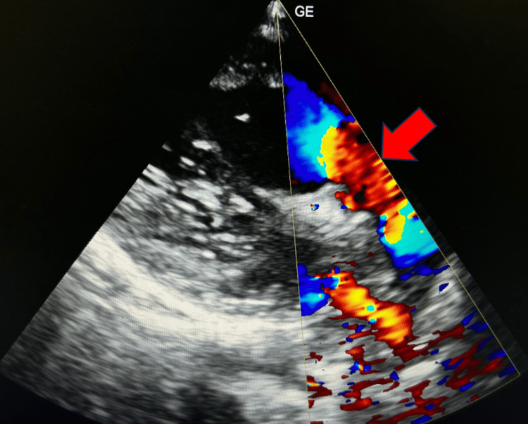 Figure 4