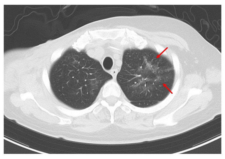 Figure 5