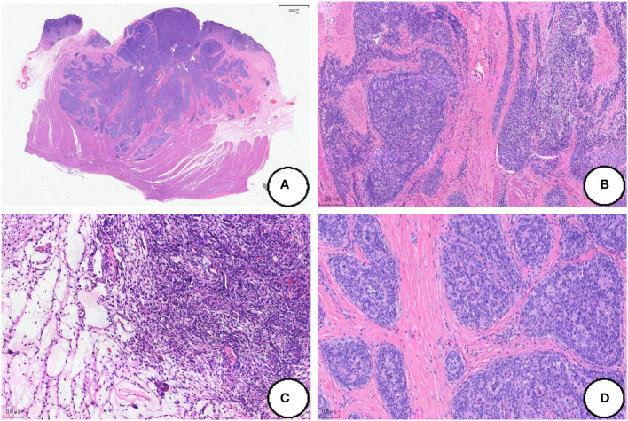 Figure 2