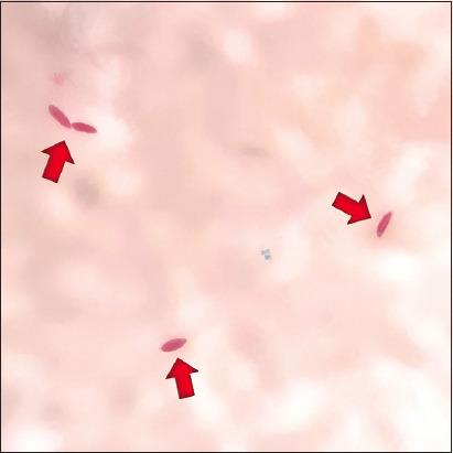 Figure-1