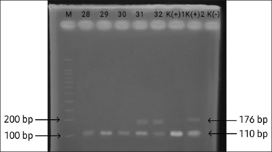 Figure-2