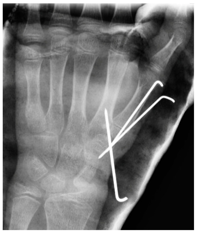 Figure 8