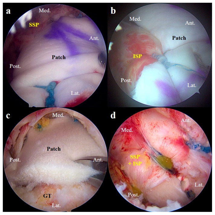Figure 4