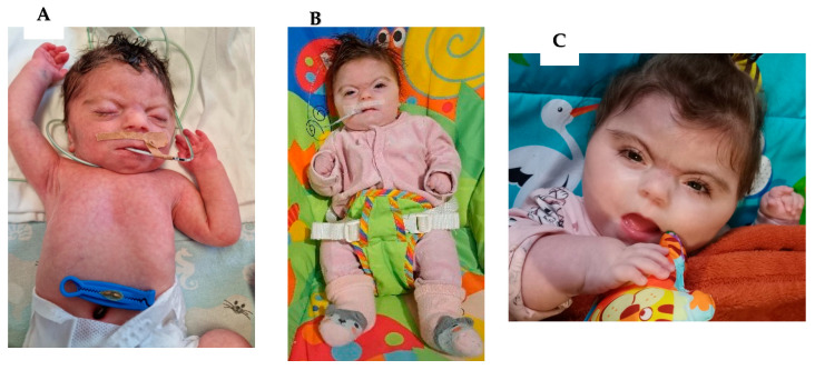Figure 2