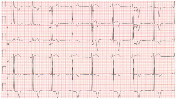 Figure 11
