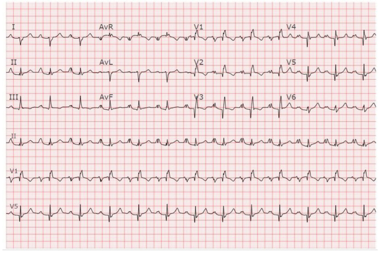 Figure 12