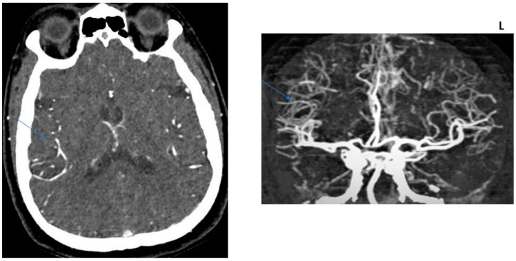 Figure 5